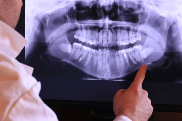 Best Emergency Gum Pain Relief  in Dunkirk, MD